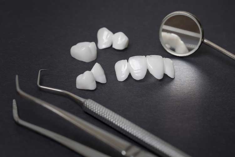 Dental crowns and dental bridges
