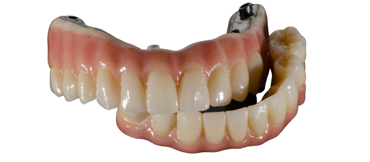 ImplantSupported Dentures Pearland, TX Implant Dentists